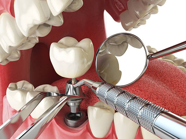 Trusted IA Emergency Dental Service Experts